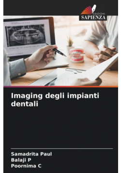Imaging degli impianti dentali