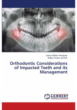 Orthodontic Considerations of Impacted Teeth and its Management