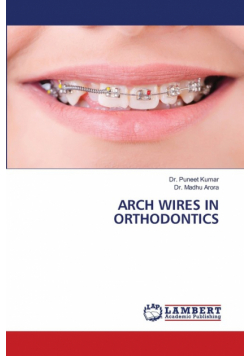Arch Wires In Orthodontics