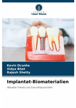 Implantat-Biomaterialien