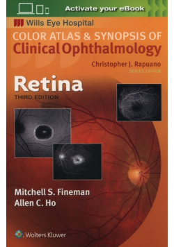 Retina