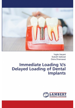 Immediate Loading V/s Delayed Loading of Dental Implants