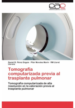Tomografía computarizada previa al trasplante pulmonar