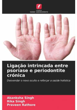 Ligação intrincada entre psoríase e periodontite crónica