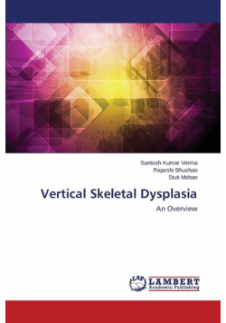 Vertical Skeletal Dysplasia