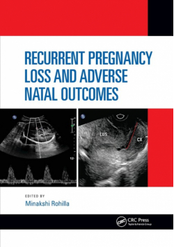 Recurrent Pregnancy Loss and Adverse Natal Outcomes