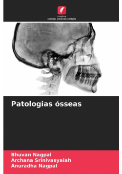 Patologias ósseas