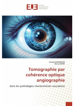 Tomographie par cohérence optique angiographie