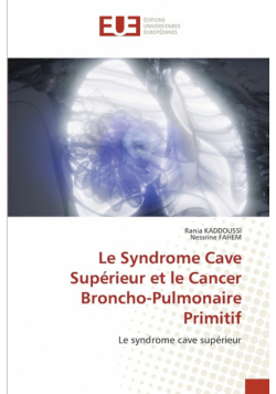 Le Syndrome Cave Supérieur et le Cancer Broncho-Pulmonaire Primitif