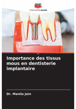 Importance des tissus mous en dentisterie implantaire
