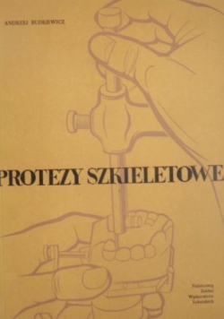 Protezy szkieletowe