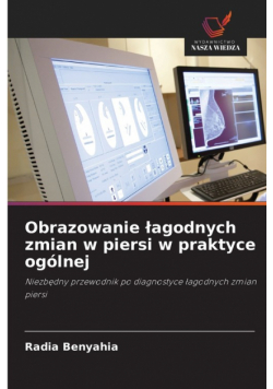 Obrazowanie łagodnych zmian w piersi w praktyce ogólnej