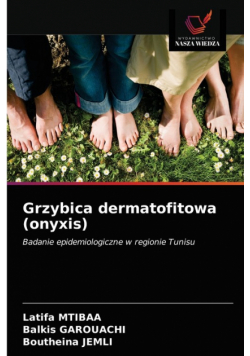 Grzybica dermatofitowa (onyxis)
