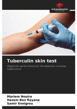 Tuberculin skin test