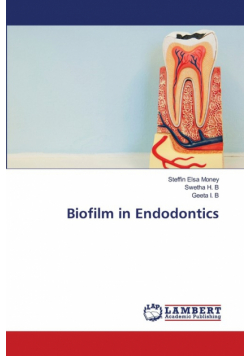 Biofilm in Endodontics