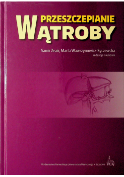 Przeszczepianie wątroby