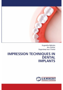 Impression Techniques In Dental Implants