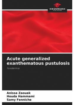 Acute generalized exanthematous pustulosis