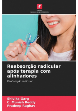 Reabsorção radicular após terapia com alinhadores