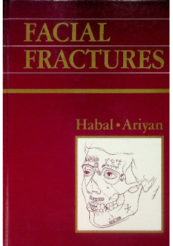 Facial Fractures