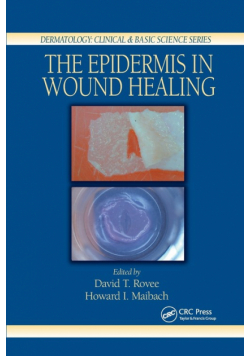 The Epidermis in Wound Healing