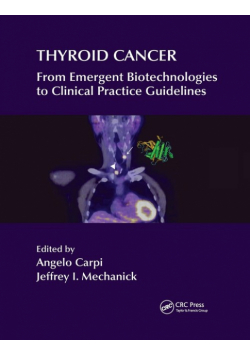 Thyroid Cancer