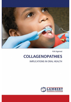Collagenopathies