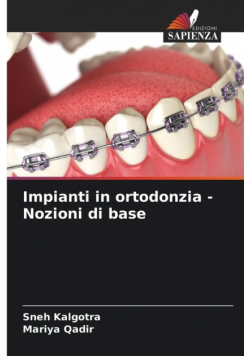 Impianti in ortodonzia - Nozioni di base