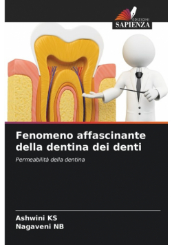 Fenomeno affascinante della dentina dei denti