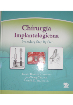 Chirurgia implantologiczna