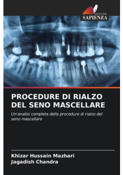 Procedure Di Rialzo Del Seno Mascellare