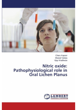 Nitric oxide
