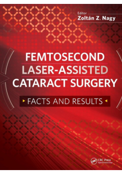 Femtosecond Laser-Assisted Cataract Surgery