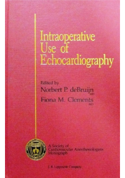 Intraoperative use of echocardiography