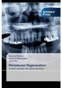 Periodontal Regeneration
