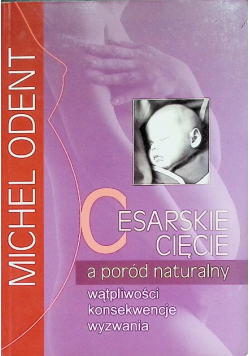 Cesarskie Cięcie A Poród Naturalny