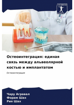 Остеоинтеграция