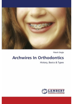 Archwires In Orthodontics