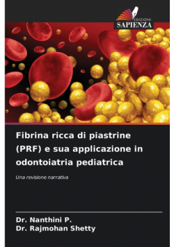 Fibrina ricca di piastrine (PRF) e sua applicazione in odontoiatria pediatrica