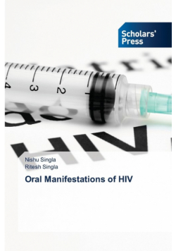 Oral Manifestations of HIV