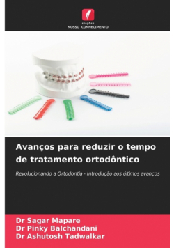 Avanços para reduzir o tempo de tratamento ortodôntico