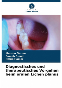 Diagnostisches und therapeutisches Vorgehen beim oralen Lichen planus
