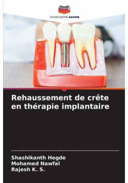 Rehaussement de crête en thérapie implantaire