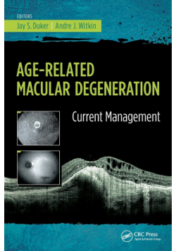 Age-Related Macular Degeneration