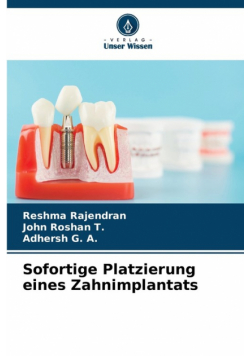 Sofortige Platzierung eines Zahnimplantats