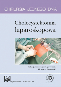 Krasowski Grzegorz - Chirurgia jednego dnia Cholecystektomia laparoskopowa