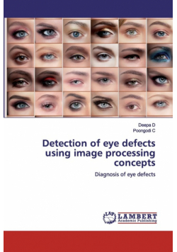 Detection of eye defects using image processing concepts