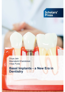 Basal Implants - a New Era in Dentistry