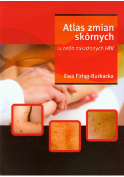 Firląg-Burkacka Ewa - Atlas zmian skórnych u osób zakażonych HIV