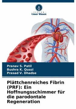 Plättchenreiches Fibrin (PRF)